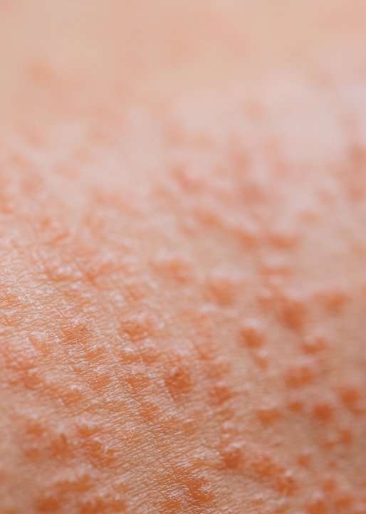 Primo piano di pelle con piccole irregolarità superficiali visibili in dettaglio